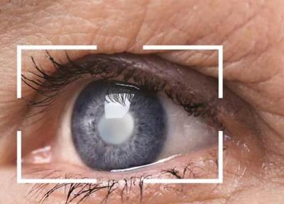 مبتلایان به بیماری های چشم درمان را جدی بگیرند