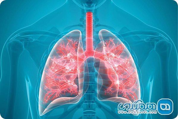فیبروز ریه از علائم تا پیشگیری فیبروز ریه از علائم تا پیشگیری